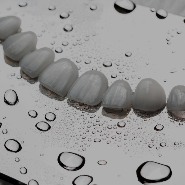 Dental Veneers