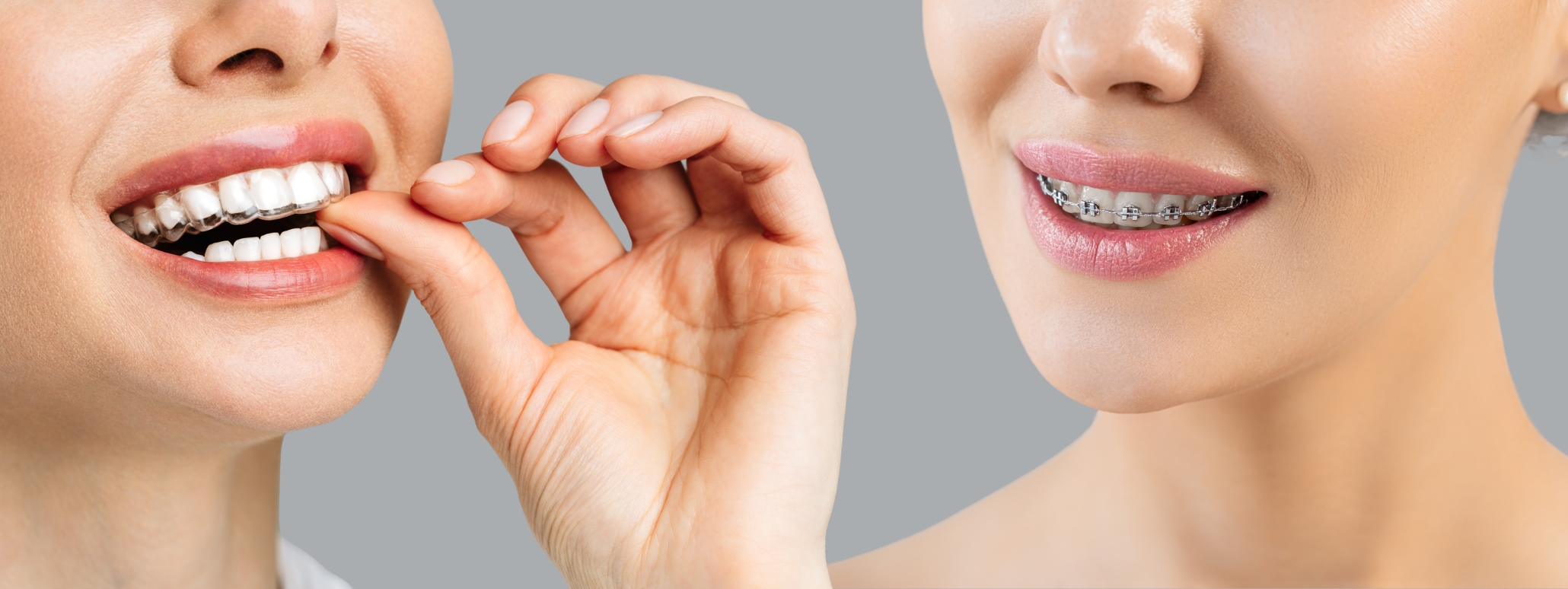 Orthodontics