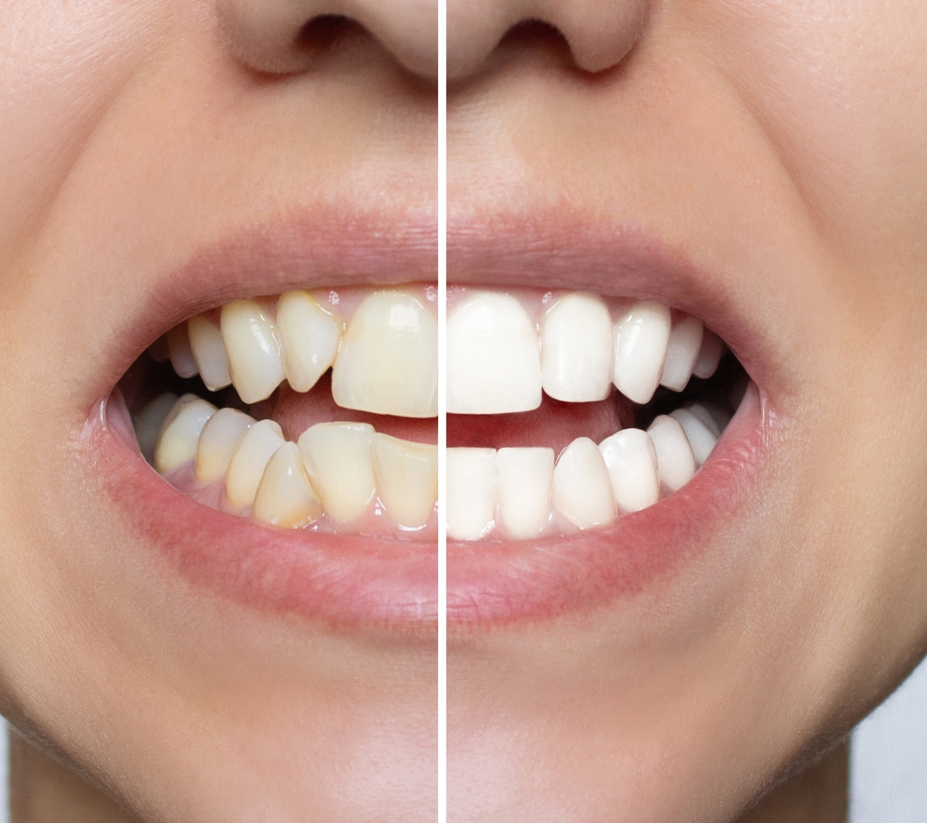 Why consider orthodontic treatment?
