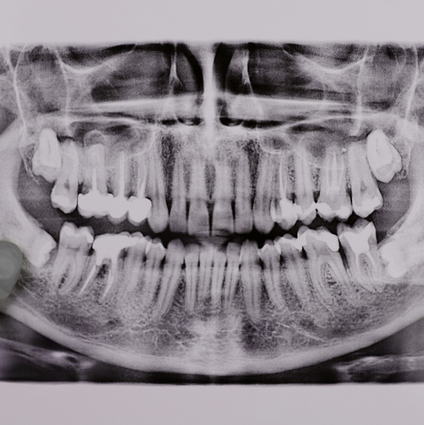 Dental Radiography