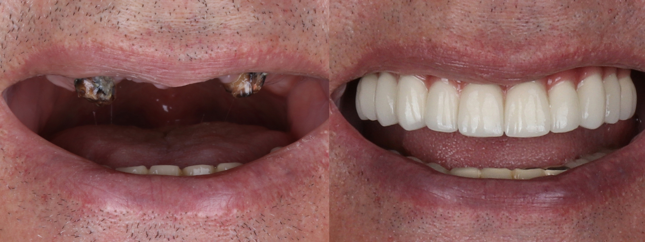 Advanced Restorative Dentistry