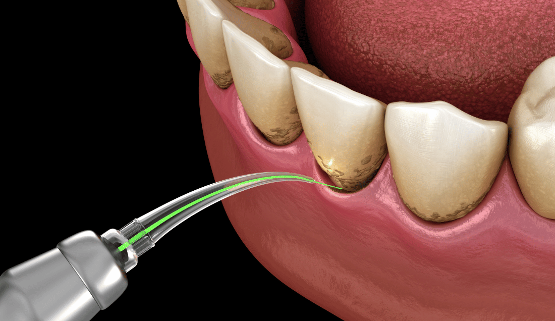 Events - Malmesbury Dental & Specialist Referral Centre