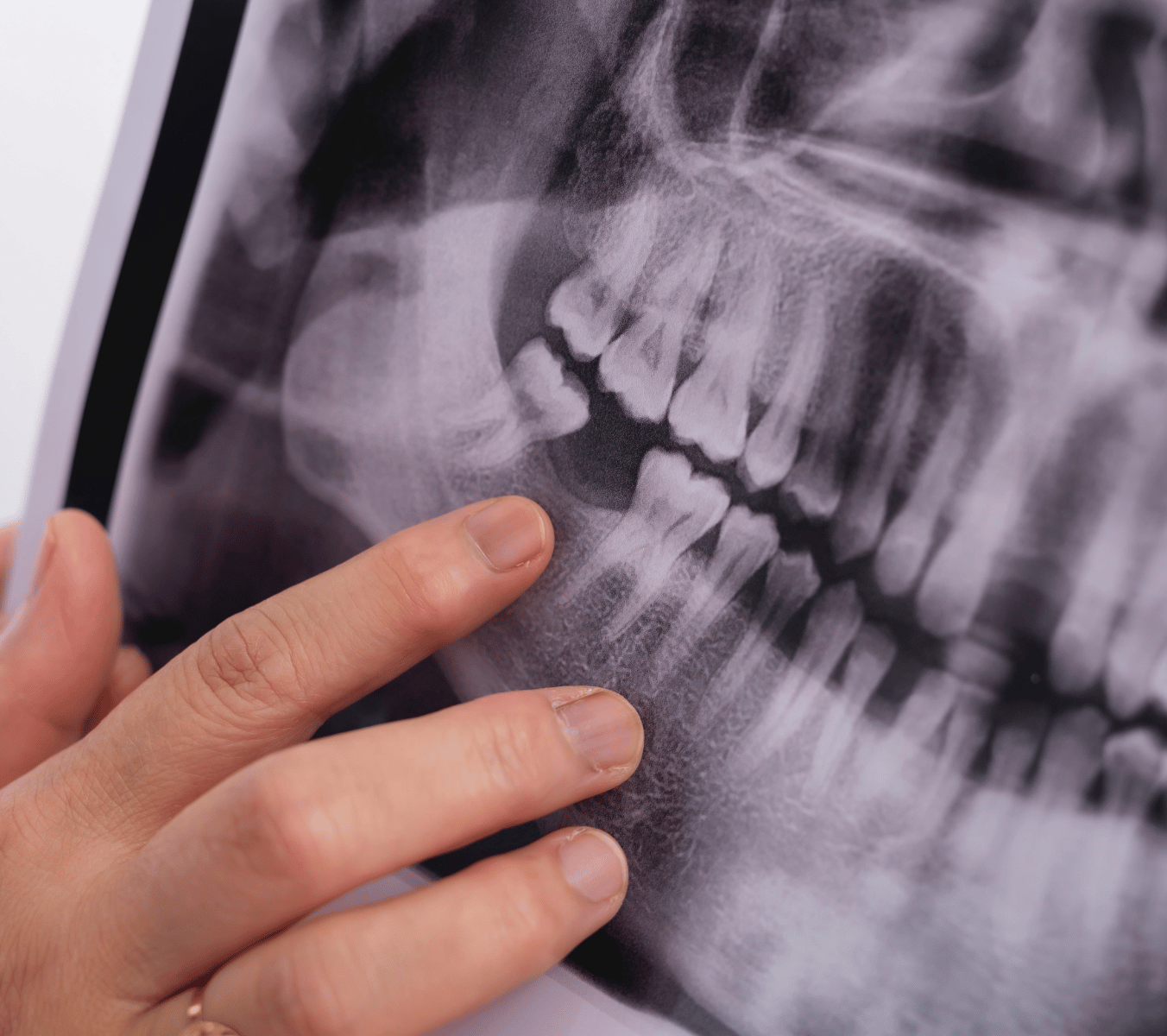 Malmesbury Dental & Specialist Referral Centre